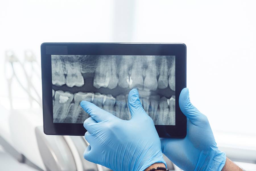 Digital Dental X-rays